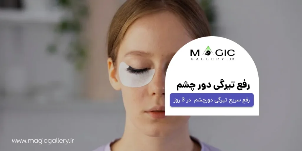 رفع تیرگی دور چشم در سه روز