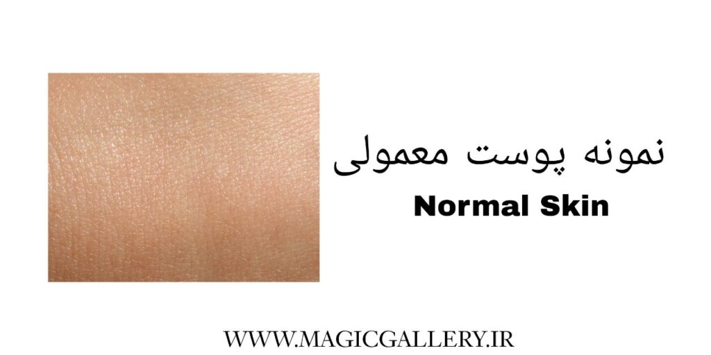 شناخت نوع پوست و اهمیت آن در مراقبتهای پوستی (راهنمای جامع + تحلیل علمی) 2 magicgallery.ir-normalskin