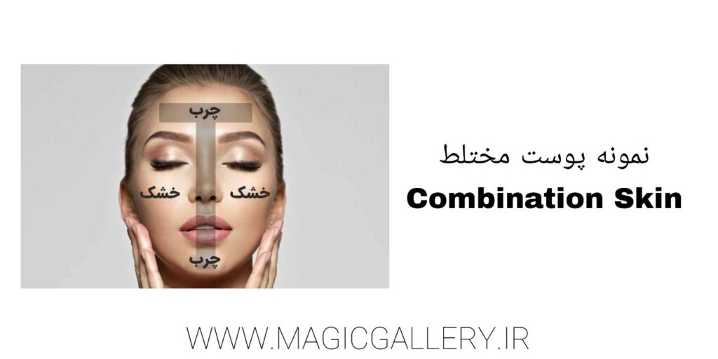 شناخت نوع پوست و اهمیت آن در مراقبتهای پوستی (راهنمای جامع + تحلیل علمی) 5 نمونه پوست مختلط